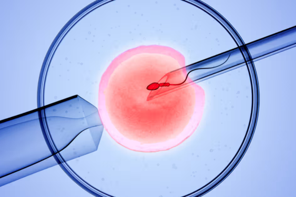 In Vitro Fertilisation (IVF) treatment in Mumbai at Fertility square IVF Clinic