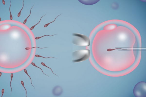 Intra Cytoplasmic Sperm Injection treatment in Mumbai at Fertility square IVF Clinic
