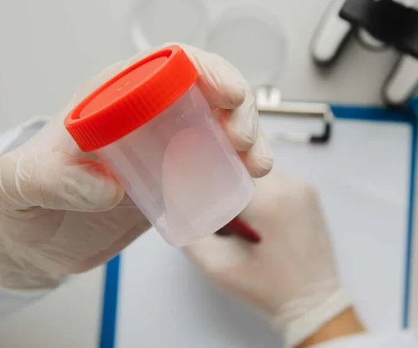 IVF treatment